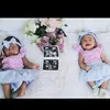 babytwintasyantisya