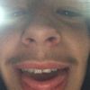 rylanbracken