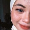 ___faz__