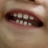 nnnnnnng137
