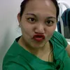 itsrhize