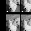 izakecil7