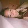 stitchesnscars