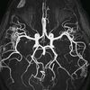 brain200houma