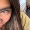 aless_lynax