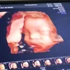 mommydaddyeunafelize