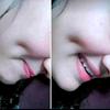 dimple_1_queen