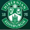 hibernian.f.c77