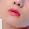 taetae1770