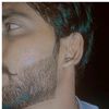 bakir_x_100