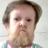 1esker3