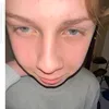 sam.adhd.barn
