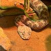sphilis