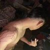 edward_rx