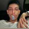highoniine