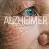 Apoio ao Alzheimer