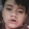 samalzate1