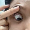 nthdchhp