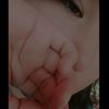 em_breat.i