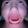 netenenel
