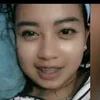 yantisepterina0