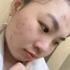 lethicamthu06