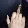 braillegve1