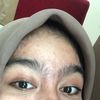 iinkorma1