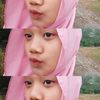 yzmlsap17