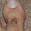 hairytoes6996