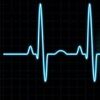 pulsemv