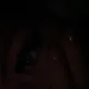 erinatkinsx