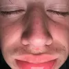 nooplermax1