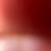 soorr35