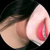 laash_perez