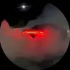 userqer14