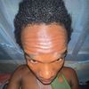 alvinofph