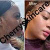 cherryskin_care