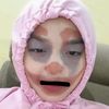 amelllaee