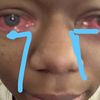 prettylightskinkoko._.11