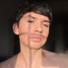 aldoz_lazos