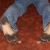 black_feet1