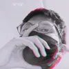 demntia1