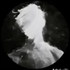nidefyas