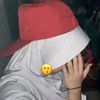 botak_kulit2