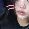 nznniaka