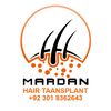 Mardan hair transplant