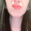 stellatipu