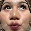 ilovemyskin17
