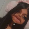 stalk.erdia
